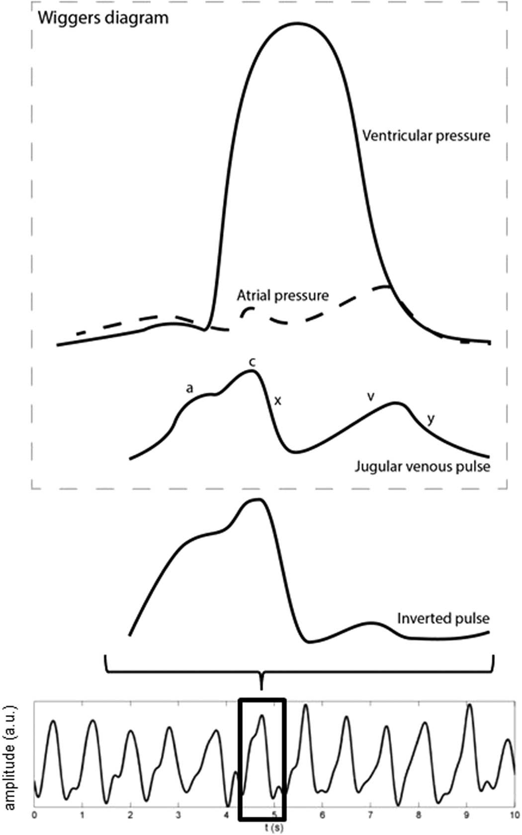 Wiggers Diagram Template